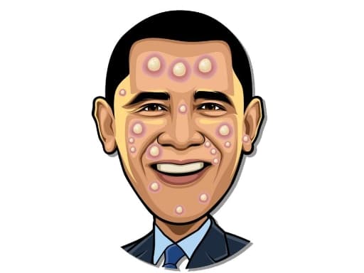 Play Celebrity Pimple Pop online